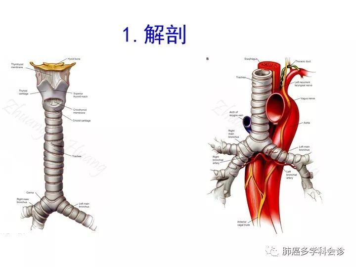 隆突切除重建术治疗局部晚期nsclc—抗癌管家