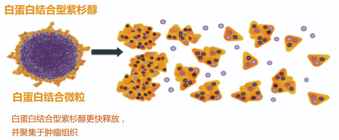 恒瑞白蛋白结合型紫杉醇——艾越重磅上市:源于紫杉,超越紫杉